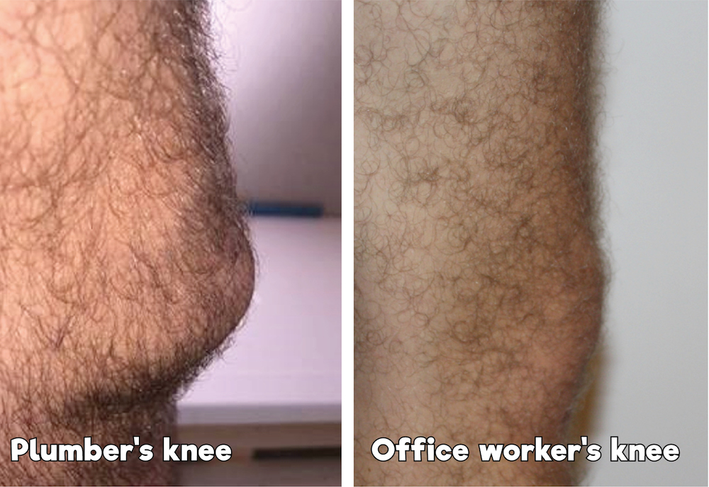 Research shows 75% of plumbers will experience knee problems