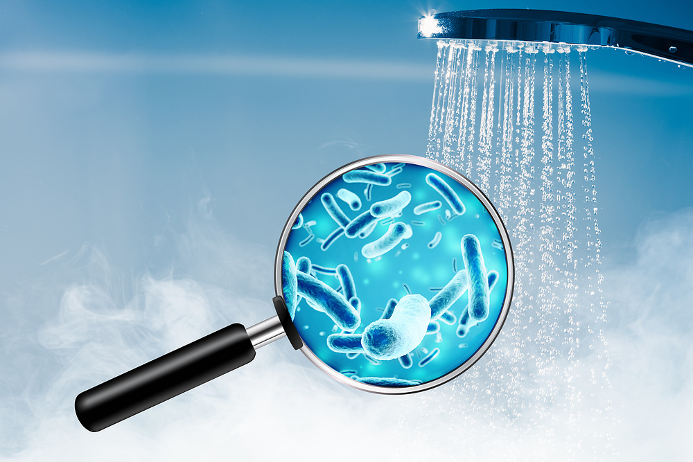 Call for action following Legionnaires’ outbreak